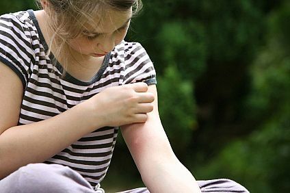 Come prevenire naturalmente le punture di zanzara