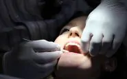 ascesso dentale