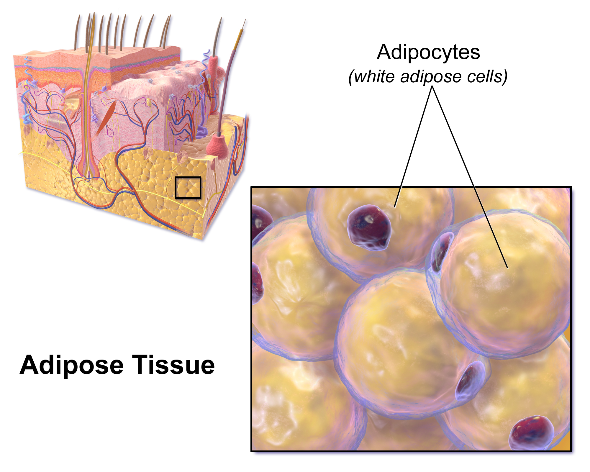 ultrasuoni cellulite