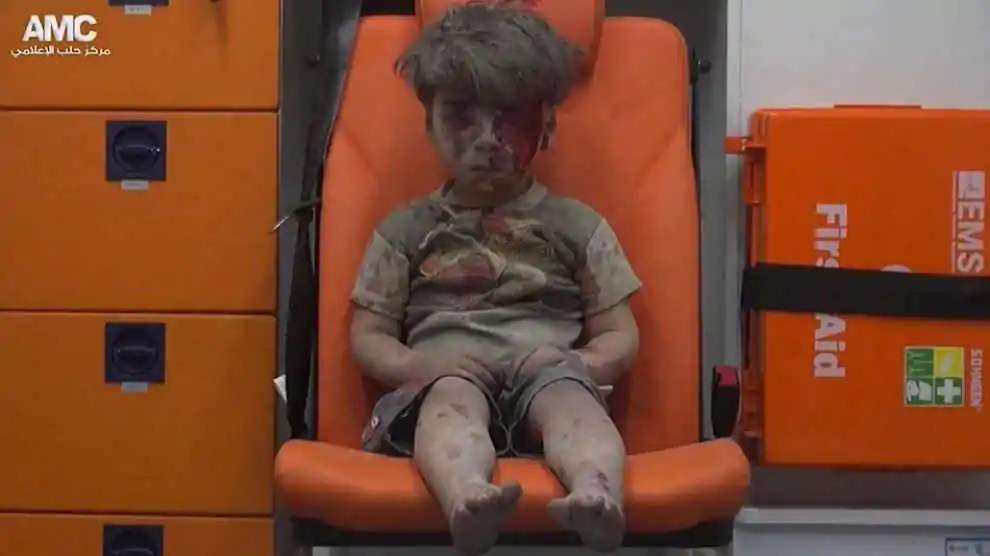 Immagini di bambini feriti ad Aleppo che diventano il simbolo della guerra e della tragedia
