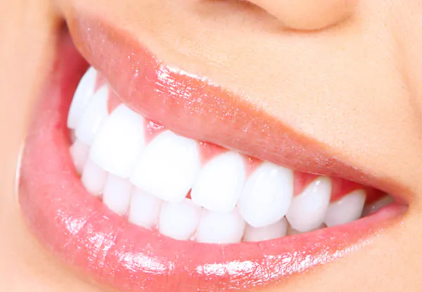 I rimedi naturali per denti bianchi e sani