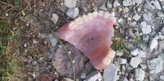 dentiera-smarrita