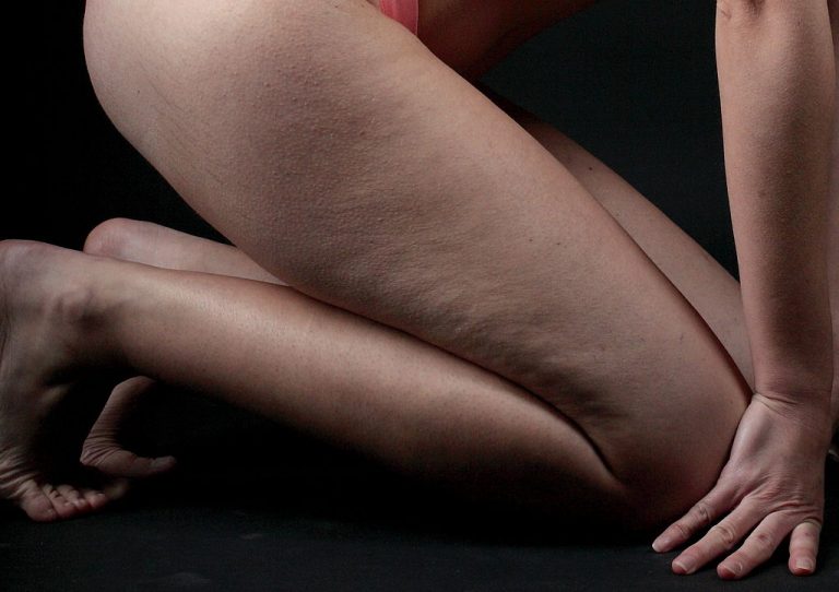 ozonoterapia