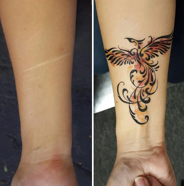 Come coprire una cicatrice con un tatuaggio
