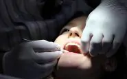 Fibroma in bocca