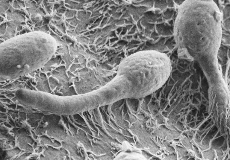candida2 768x535