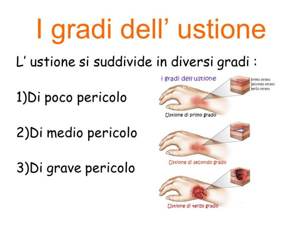 gradi-di-ustione