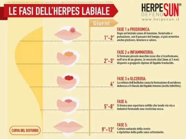 fasi dell'herpes labiale