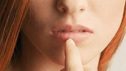 Herpes labiale: come evitare il contagio con altre persone