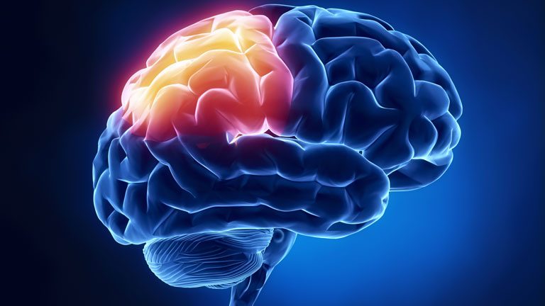 Ictus: sintomi e cause che lo provocano