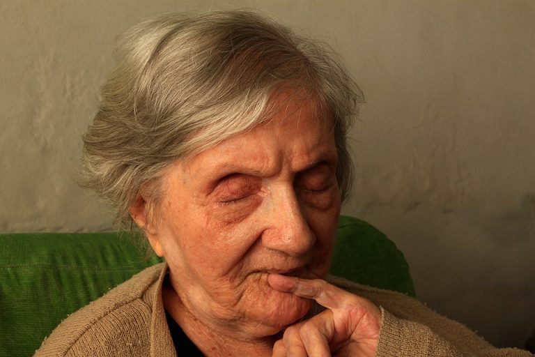 morbo di alzheimer
