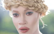Diandra: la modella albina che sta facendo impazzire il web