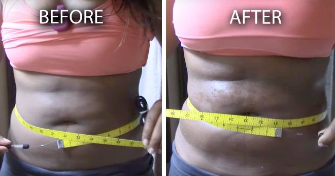 how to lose belly fat overnight with vaseline