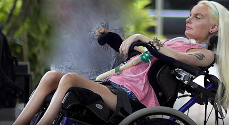 Ragazza paraplegica vive e si veste come Barbie