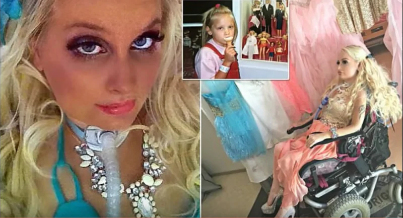 Ragazza paraplegica vive e si veste come Barbie