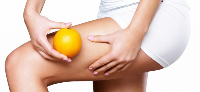 Buchi da cellulite: rimedi chirurgici