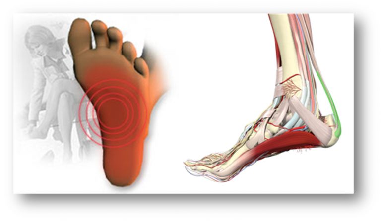 fascia