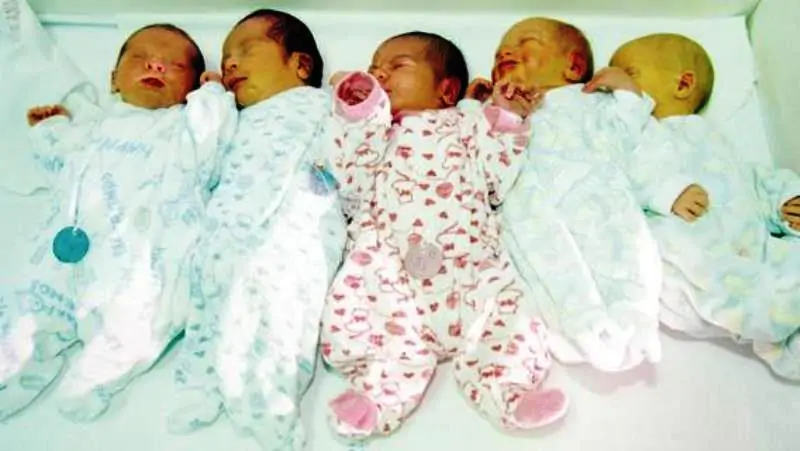 Parto plurigemellare: donna da alla luce cinque gemelli