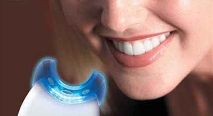 Sbiancamento dei denti