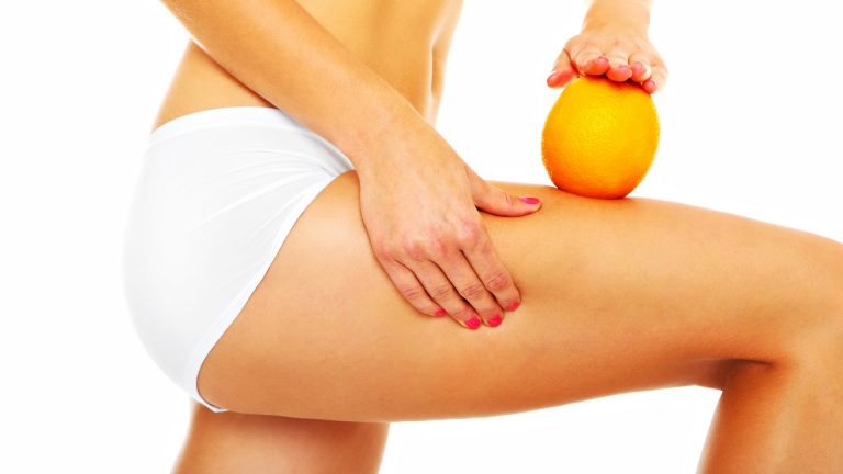 cellulite cellulite