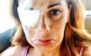 vanessa incontrada ferita allocchio la foto su instagram