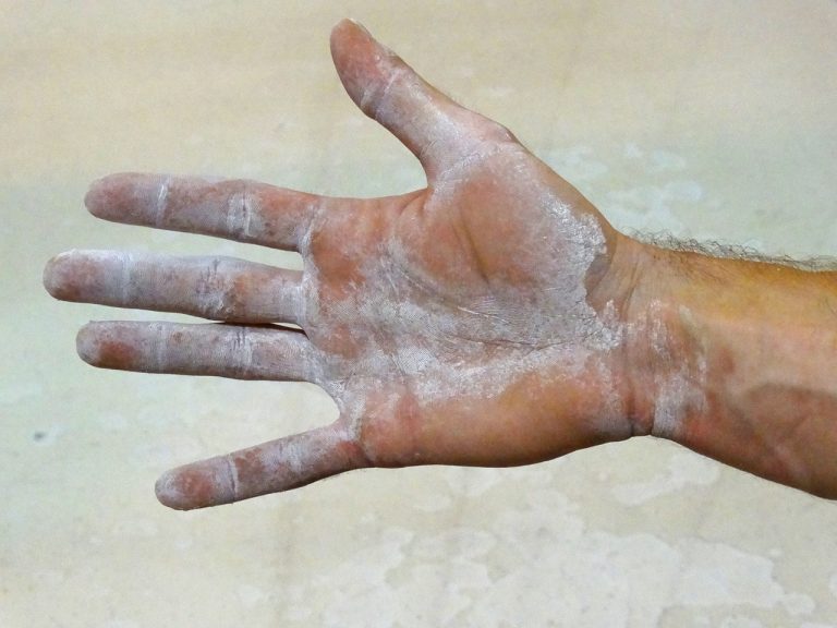 carenza di magnesio