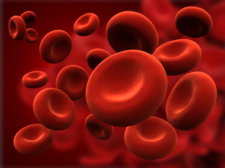 Sindrome di Sjogren