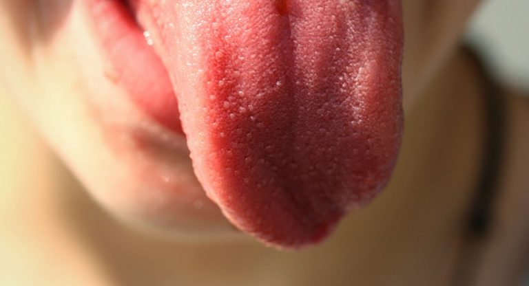 lingua