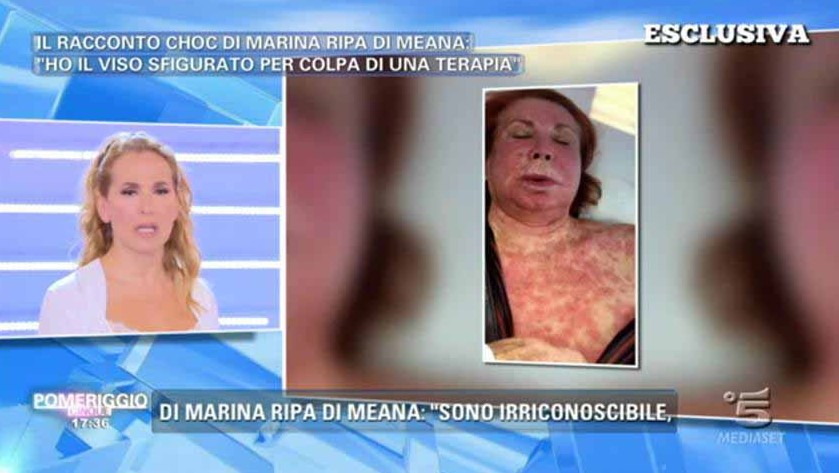 Risultato di una terapia