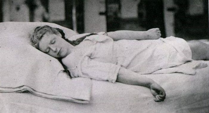 Ragazza in stato catatonico