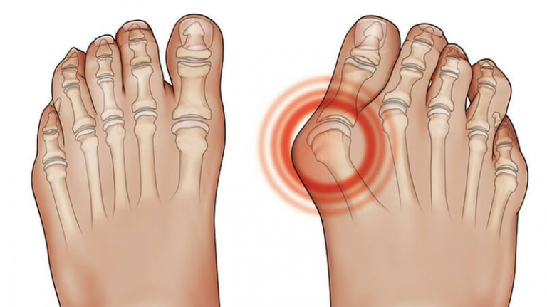dita dei piedi