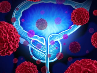 come mantenere efficiente la prostata come mantenere efficiente la prostata