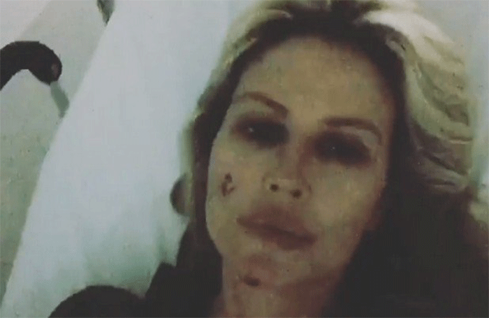 Nathalie Caldonazzo, il video shock dopo l'incidente Nathalie Caldonazzo, il video shock dopo l'incidente