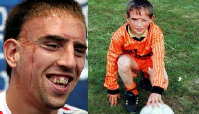 ribery