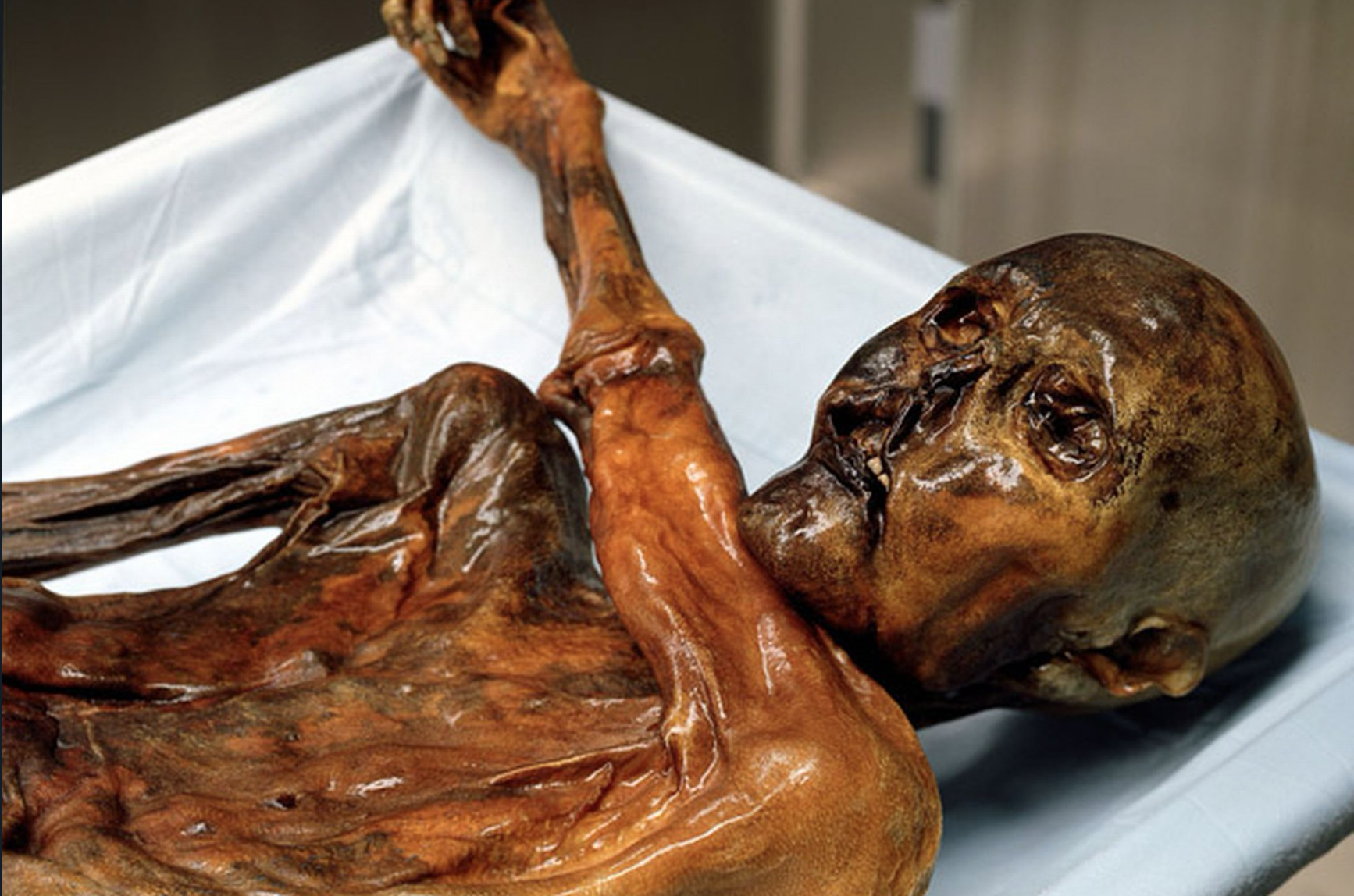 Ötzi