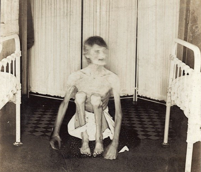 rhoda derry