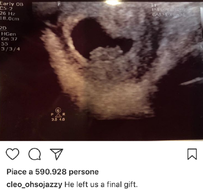 XXXTentacion
