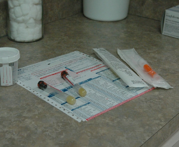 analisi sangue
