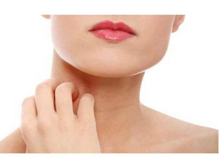 dermatite da stress dermatite da stress