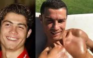 Cristiano Ronaldo Prima e dopo