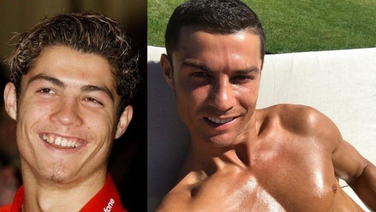 Cristiano Ronaldo Prima e dopo