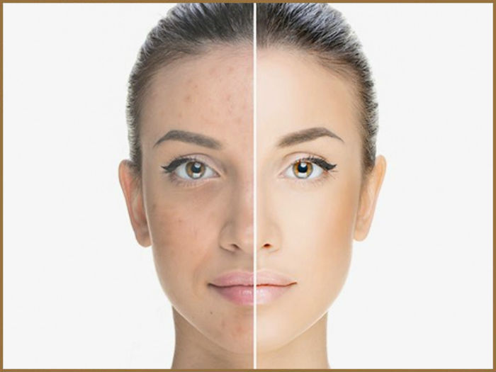 Dermaskin