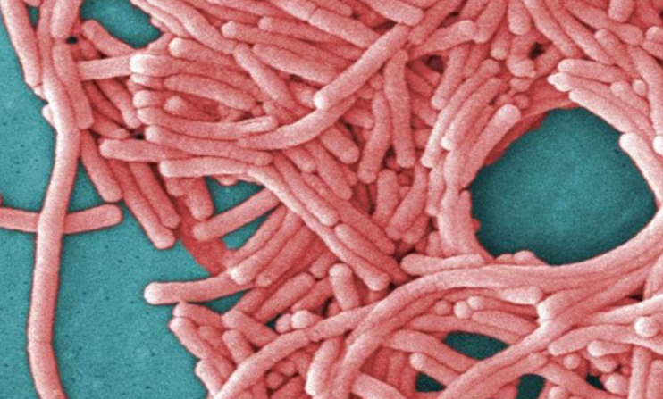 Legionella
