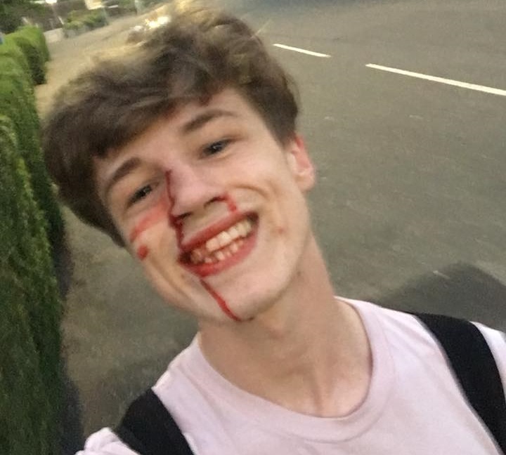 Picchiato perchè gay, ma lui posta la sua foto sorridendo