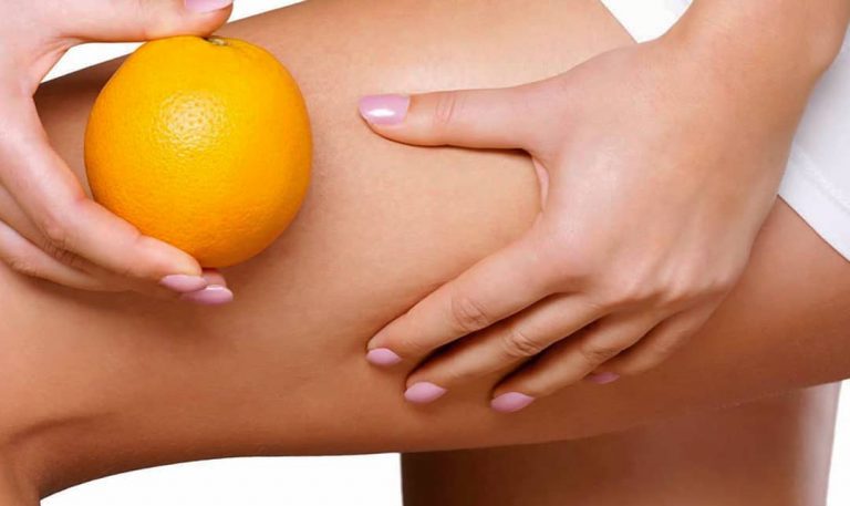 vacuum cellulite