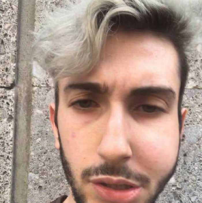 Ragazzo gay aggredito