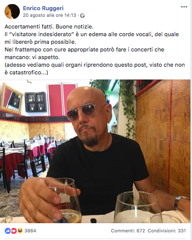 Ruggeri edema corde vocali