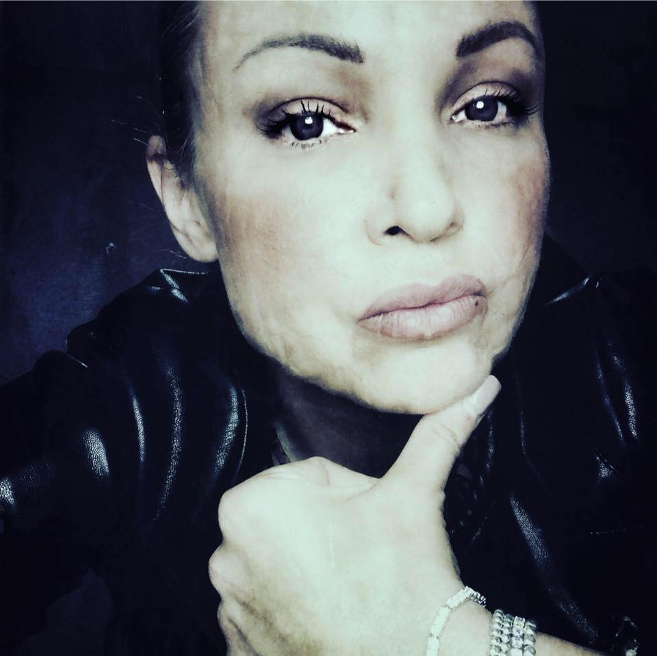 cristina ex modella sfigurata
