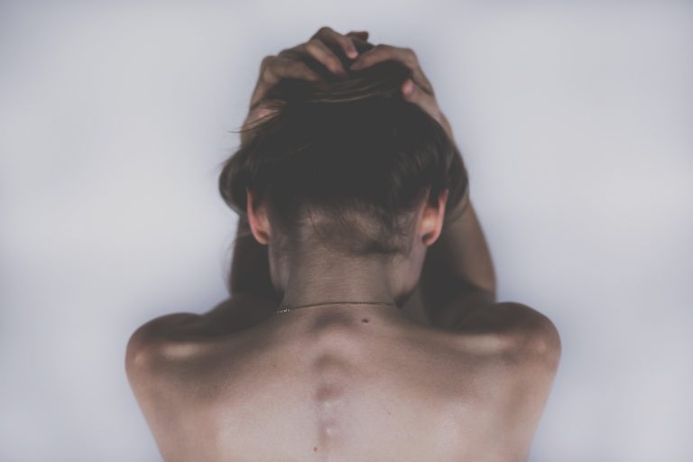 Brufoli schiena, come eliminarli naturalmente