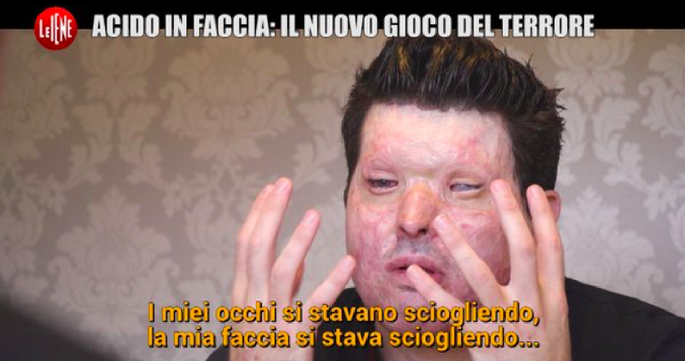 acido faccia gioco terrore inghilterra